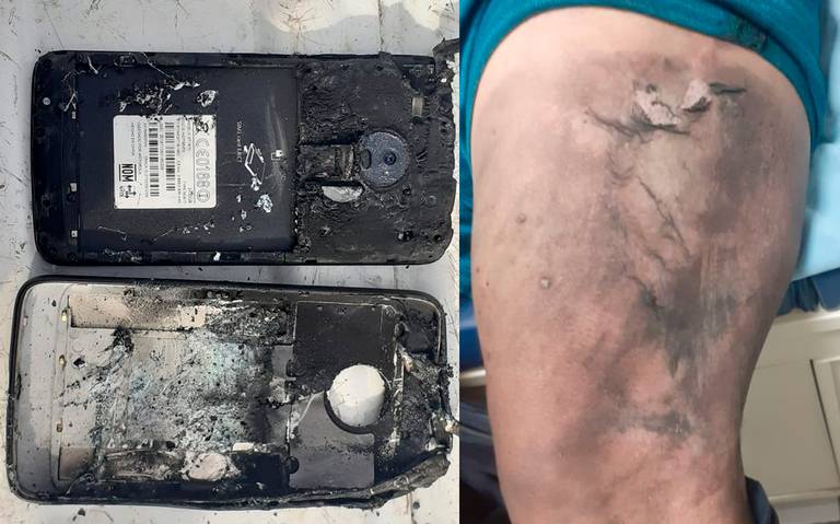 Teléfono celular explotó y provocó quemaduras a un Policía Estatal - El Sol  de Tampico | Noticias Locales, Policiacas, sobre México, Tamaulipas y el  Mundo